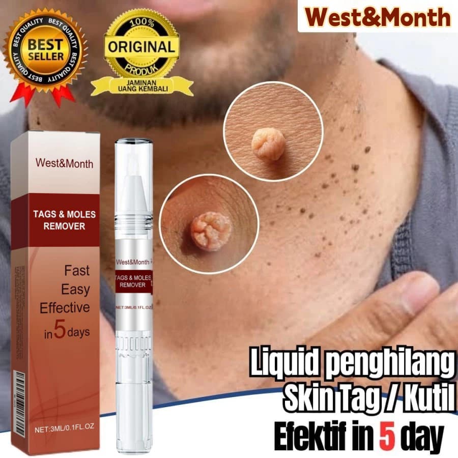 Gambar dari Tags & Moles Remover Krim Penghilang Kutil dan Tahi Lalat