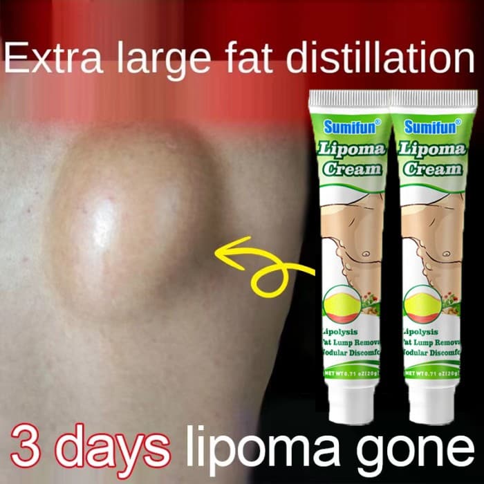 Gambar dari Obat Salep Cream Ampuh Hilangkan Benjolan Lipoma Kelenjar Tiroid